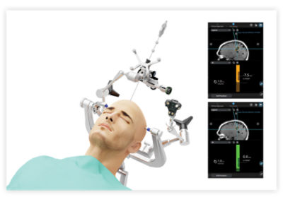 Cranial Guidance Software | Stryker